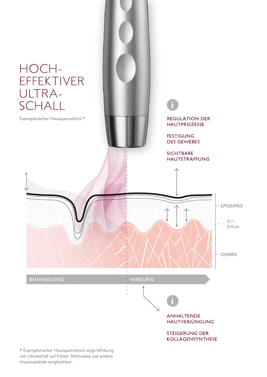 Skinprofiler reviderm celljet ultraschall haut hautschichten wirkung 10 megahertz